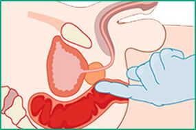 Prostate massage - treatment of prostatitis